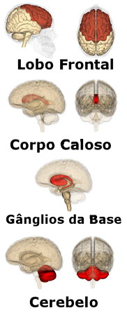 Cerebro Hiperatividade